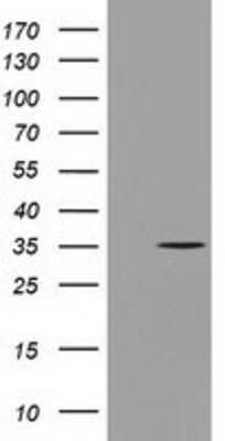 Western Blot: GGPS1 Antibody (OTI3F9) [NBP2-03037]