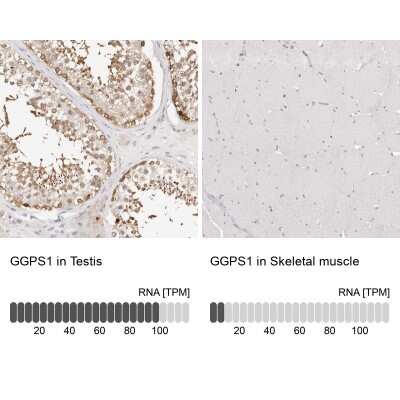 Immunohistochemistry-Paraffin: GGPS1 Antibody [NBP1-83368]