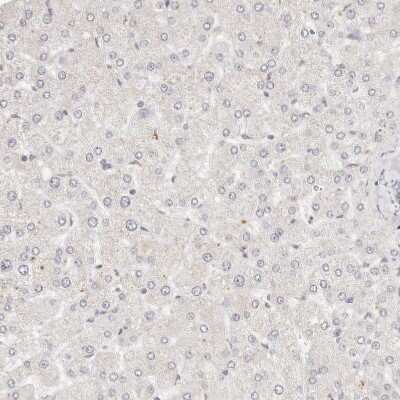Immunohistochemistry-Paraffin: GGPS1 Antibody [NBP1-83368]