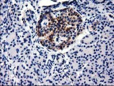 Immunohistochemistry: GGPS1 Antibody (OTI3F9) - Azide and BSA Free [NBP2-71463]