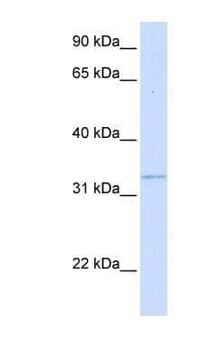 Western Blot: GGPS1 Antibody [NBP1-53050]