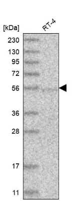 Western Blot: GGPS1 Antibody [NBP1-83368]