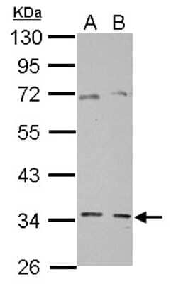 Western Blot: GGPS1 Antibody [NBP2-16652]