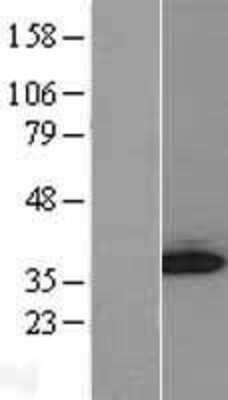 Western Blot: GGPS1 Overexpression Lysate [NBL1-11058]