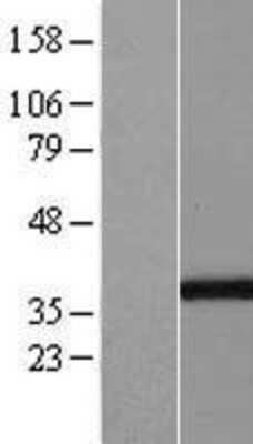 Western Blot: GGPS1 Overexpression Lysate [NBL1-11059]