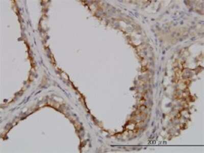 Immunohistochemistry-Paraffin: GGT1 Antibody (1F9) [H00002678-M01]