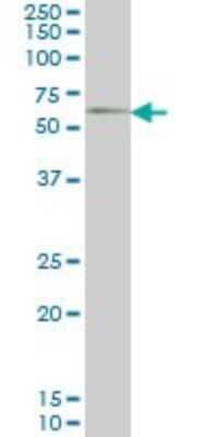 Western Blot: GGT1 Antibody (1F9) [H00002678-M01]