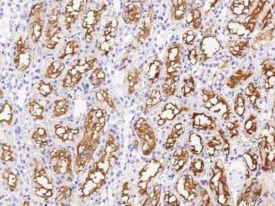 Immunohistochemistry-Paraffin: GGT1 Antibody [NBP2-98438]