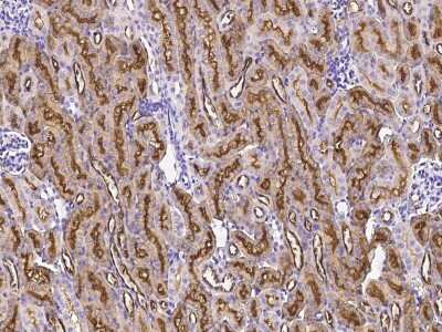 Immunohistochemistry-Paraffin: GGT1 Antibody [NBP2-98975]