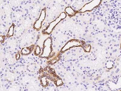 Immunohistochemistry-Paraffin: GGT1 Antibody [NBP2-98975]