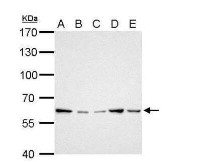 Western Blot: GGT1 Antibody [NBP1-32412]