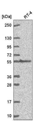 Western Blot: GGT1 Antibody [NBP2-56998]