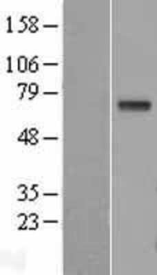 Western Blot: GGT1 Overexpression Lysate [NBL1-11060]