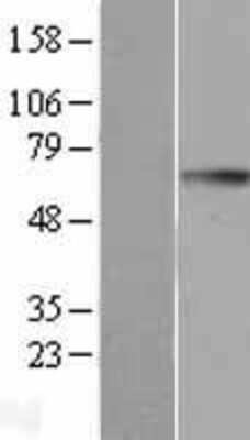 Western Blot: GGT1 Overexpression Lysate [NBL1-11061]