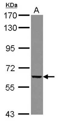 Western Blot: GGT5 Antibody [NBP2-16653]