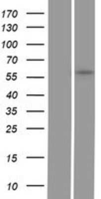 Western Blot: GGT5 Overexpression Lysate [NBP2-08298]