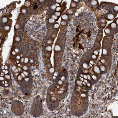 Immunohistochemistry: GGT6 Antibody [NBP1-81883]