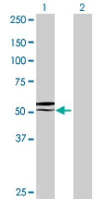 Western Blot: GGT6 Antibody [H00124975-B01P]