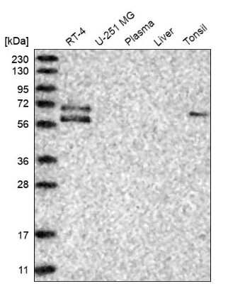 Western Blot: GGT6 Antibody [NBP1-81882]