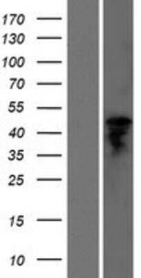 Western Blot: GGT6 Overexpression Lysate [NBP2-05256]