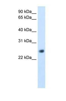 Western Blot: GGTLC1 Antibody [NBP1-56928]