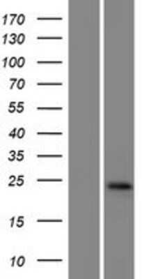 Western Blot: GGTLC1 Overexpression Lysate [NBP2-04983]