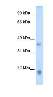 Western Blot: Growth Hormone 2 Antibody [NBP1-59316]