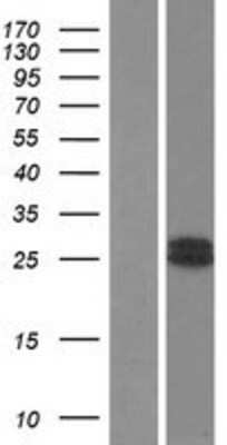 Western Blot: Growth Hormone 2 Overexpression Lysate [NBP2-08151]