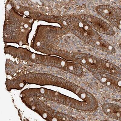 Immunohistochemistry-Paraffin: GHDC Antibody [NBP1-81309]