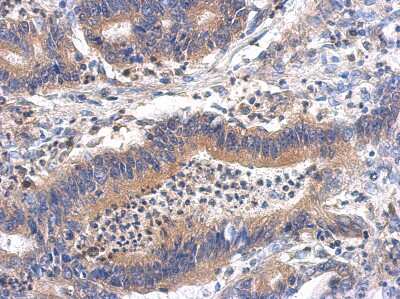 Immunohistochemistry-Paraffin: GHDC Antibody [NBP2-16654]
