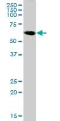 Western Blot: GHDC Antibody [H00084514-B01P]