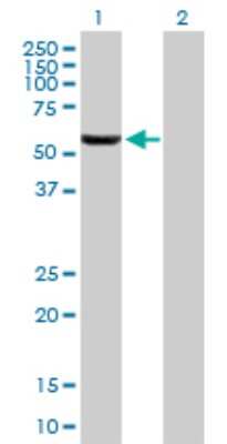 Western Blot: GHDC Antibody [H00084514-B01P]