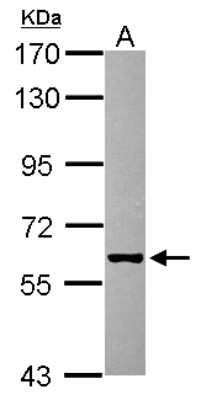 Western Blot: GHDC Antibody [NBP2-16654]