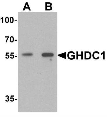 Western Blot: GHDC AntibodyBSA Free [NBP2-82091]