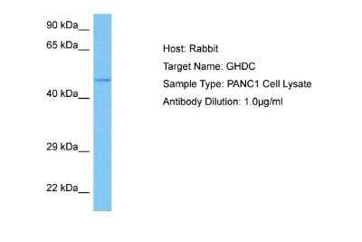 Western Blot: GHDC Antibody [NBP2-87497]