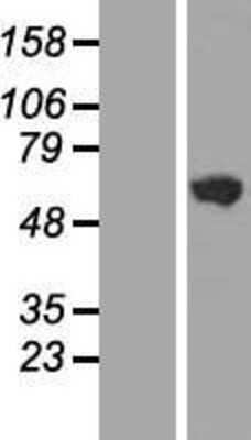 Western Blot: GHDC Overexpression Lysate [NBL1-11065]