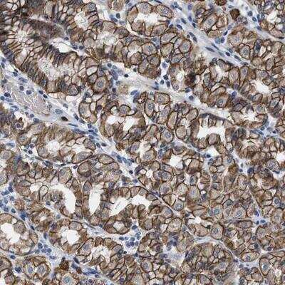 Immunohistochemistry-Paraffin: GHITM Antibody [NBP1-84269]