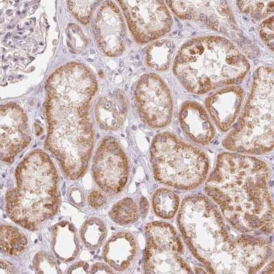 Immunohistochemistry-Paraffin: GHITM Antibody [NBP2-49344]
