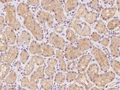 Immunohistochemistry-Paraffin: GHITM Antibody [NBP3-06232]