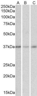 Western Blot: GHITM Antibody [NBP1-47217]