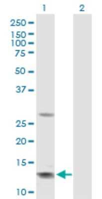 Western Blot: GHRH Antibody [H00002691-D01P]