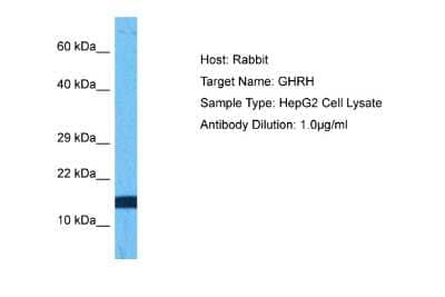 Western Blot: GHRH Antibody [NBP2-86651]