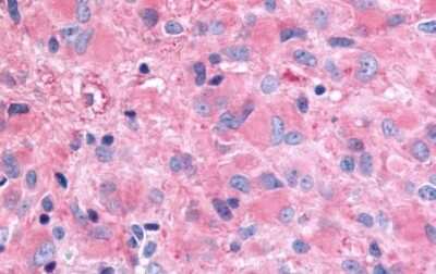 Immunohistochemistry-Paraffin: Ghrelin Receptor/GHSR Antibody - BSA Free [NLS582]