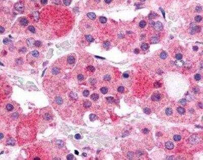 Immunohistochemistry-Paraffin: GHRHR Antibody - BSA Free [NLS836]