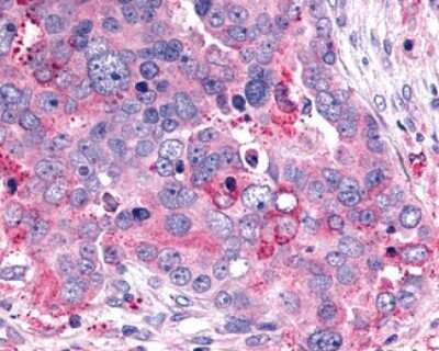 Immunohistochemistry-Paraffin: GHRHR Antibody - BSA Free [NLS836]