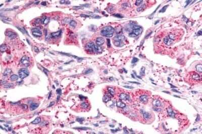 Immunohistochemistry-Paraffin: GHRHR Antibody - BSA Free [NLS836]