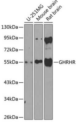 Western Blot: GHRHR AntibodyBSA Free [NBP3-04431]