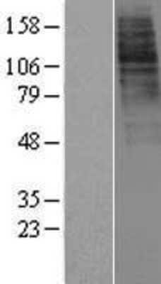 Western Blot: Ghrelin Receptor/GHSR Overexpression Lysate [NBP2-07908]