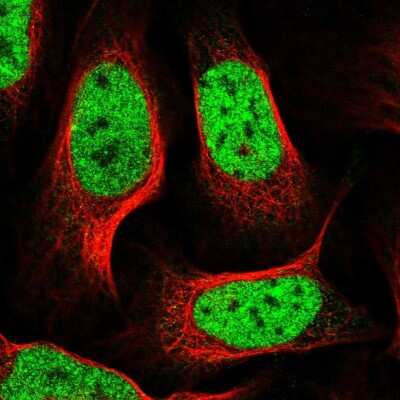 Immunocytochemistry/ Immunofluorescence: GIDRP88 Antibody [NBP1-91939]