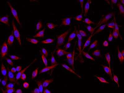 Immunocytochemistry/ Immunofluorescence: GIF Antibody (007) [NBP2-90225]